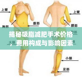 揭秘吸脂減肥手術(shù)價(jià)格，費用構成與影響因素全解析